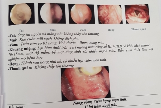 PHẪU THUẬT UNG THƯ LỢI HÀM SỬ DỤNG NẸP VÍT SINH HỌC ĐẢM BẢO TÍNH THẨM MỸ 